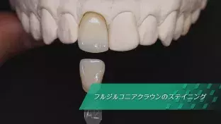 体験版】教えて！ペイント番長！ 3回焼成で行うフルジルコニア